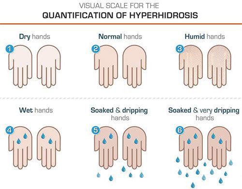 Hyperhidrosis DIagnosis and Treatment